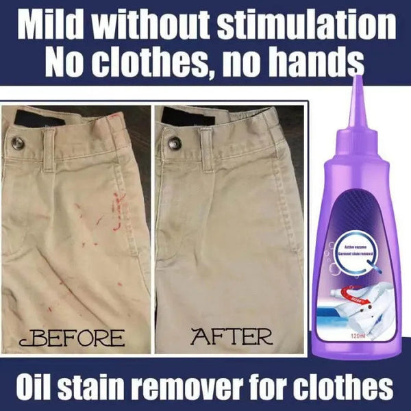 Laundry Stain Remover - SassQuality