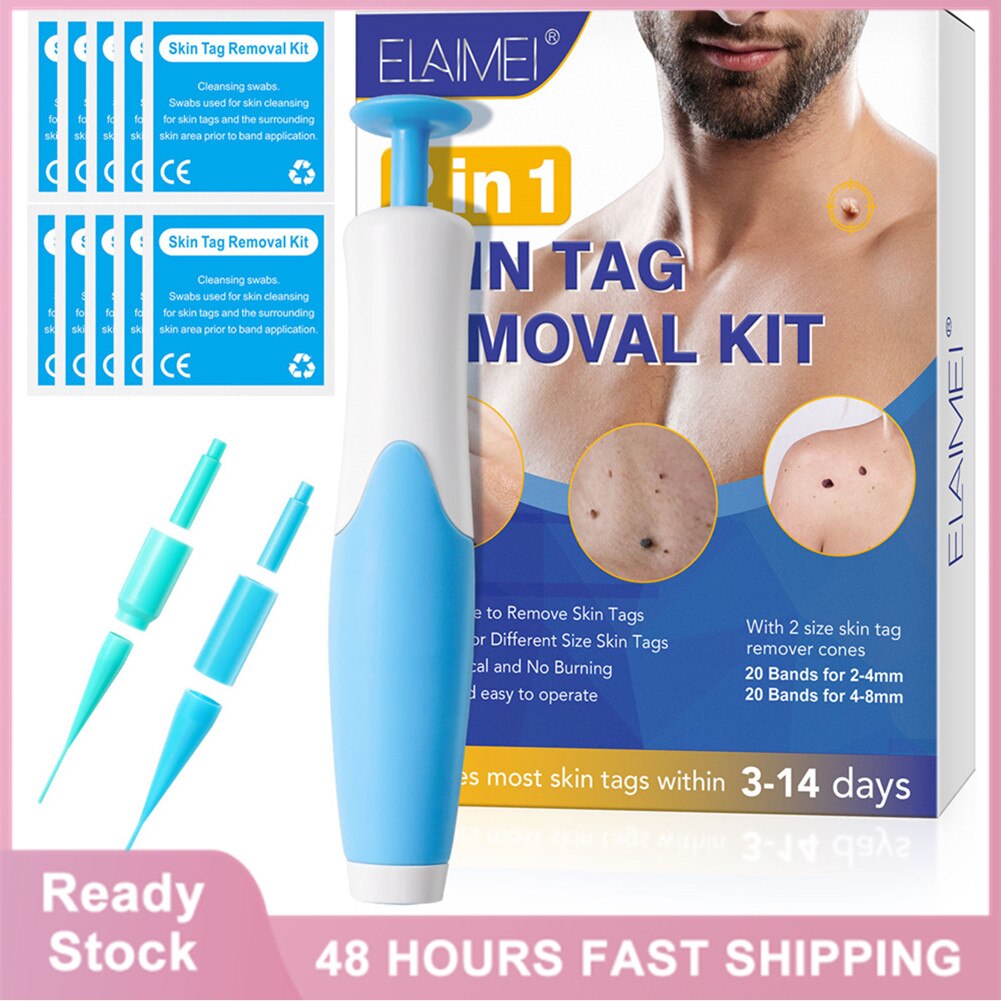 SassQuality™ 2-in-1 Skin Tag Remover Kit - SassQuality