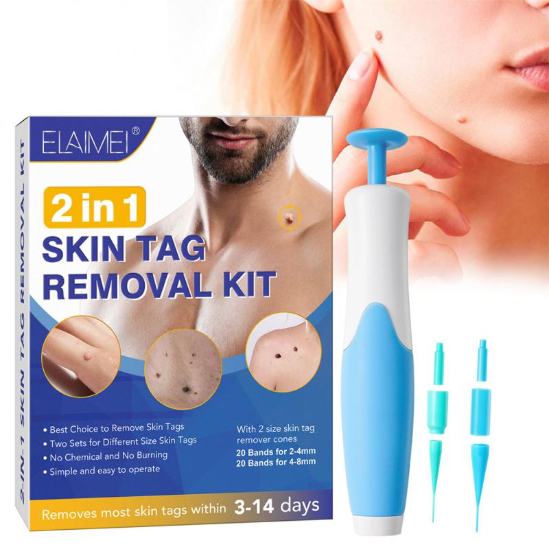 SassQuality™ 2-in-1 Skin Tag Remover Kit - SassQuality